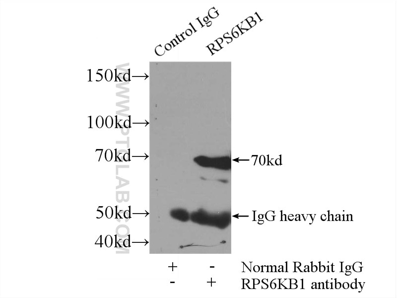 IP experiment of HeLa using 14485-1-AP