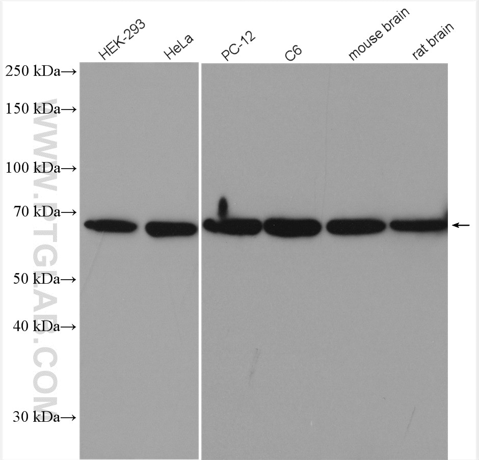 Western Blot (WB) analysis of various lysates using p70(S6K) Polyclonal antibody (14485-1-AP)