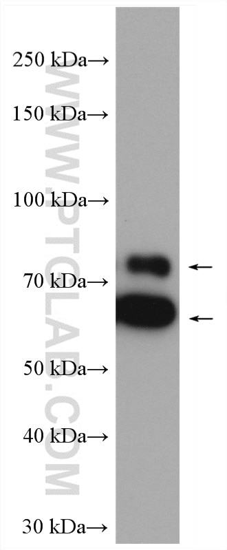 Western Blot (WB) analysis of MCF-7 cells using p70(S6K) Polyclonal antibody (14485-1-AP)