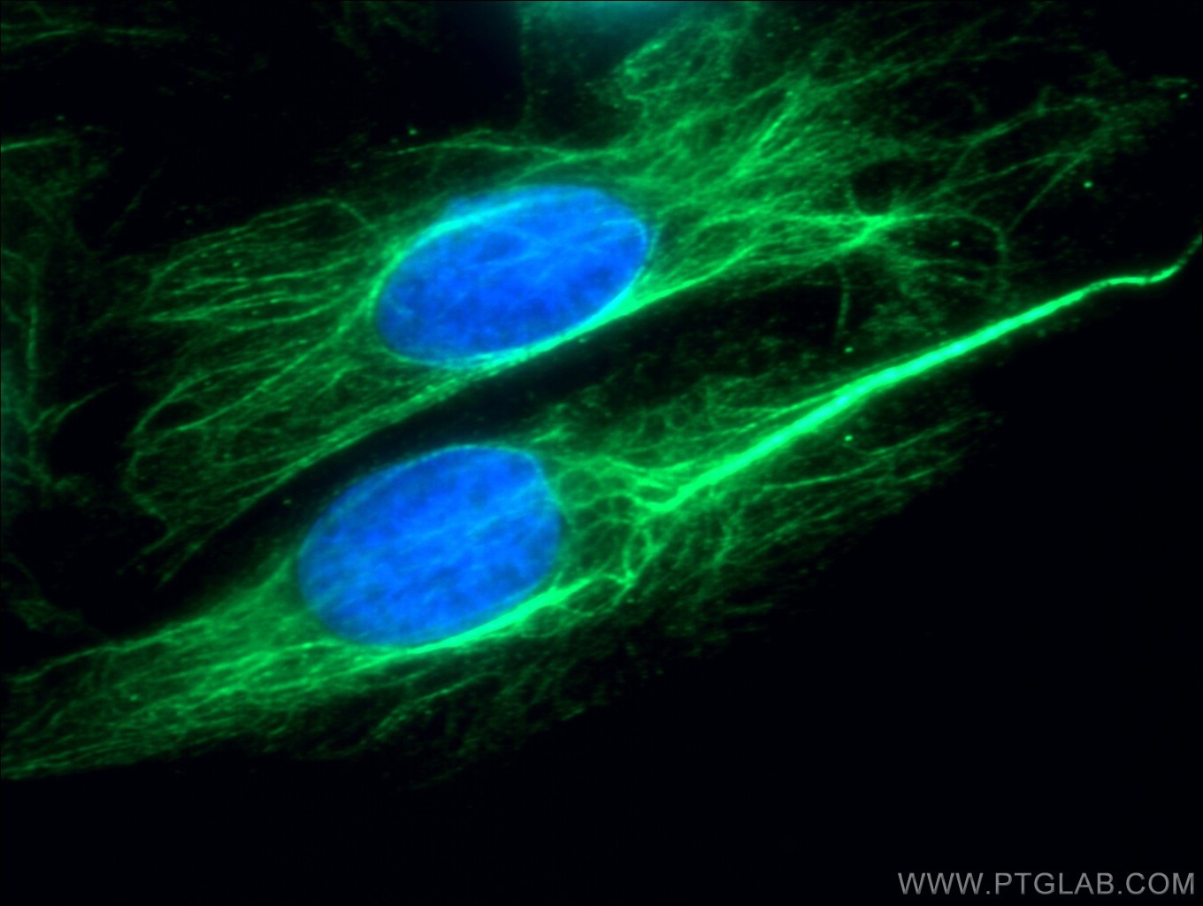 Immunofluorescence (IF) / fluorescent staining of A549 cells using p70(S6K) Polyclonal antibody (26587-1-AP)