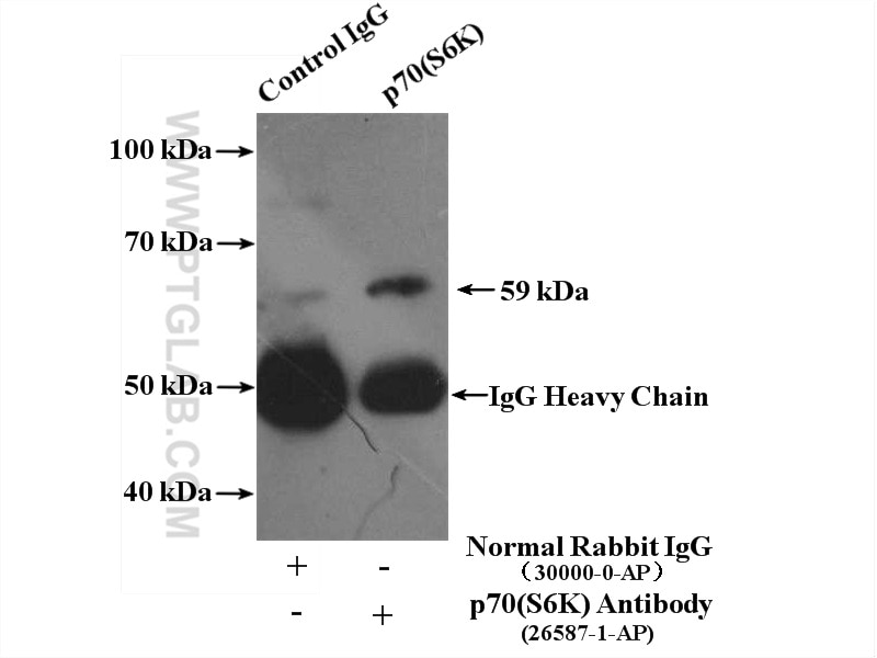Immunoprecipitation (IP) experiment of A549 cells using p70(S6K) Polyclonal antibody (26587-1-AP)