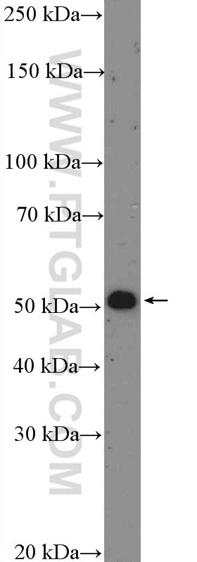 Western Blot (WB) analysis of A549 cells using p70(S6K) Polyclonal antibody (26587-1-AP)