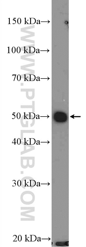 Western Blot (WB) analysis of MCF-7 cells using p70(S6K) Polyclonal antibody (26587-1-AP)