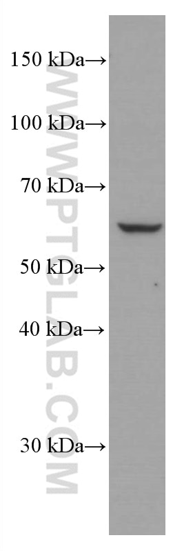 Western Blot (WB) analysis of HEK-293 cells using p70(S6K) Monoclonal antibody (66638-1-Ig)