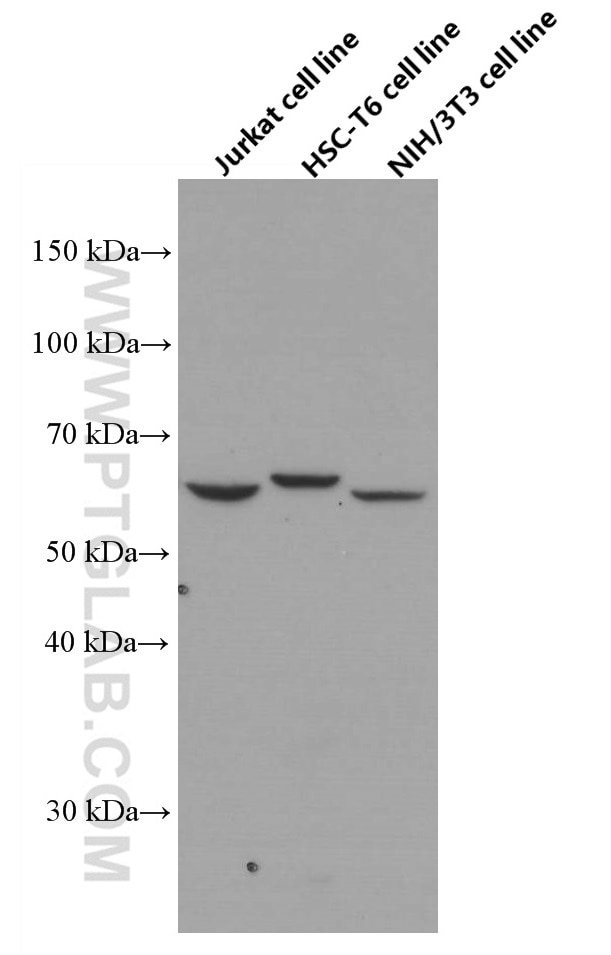 Western Blot (WB) analysis of Jurkat cells using p70(S6K) Monoclonal antibody (66638-1-Ig)