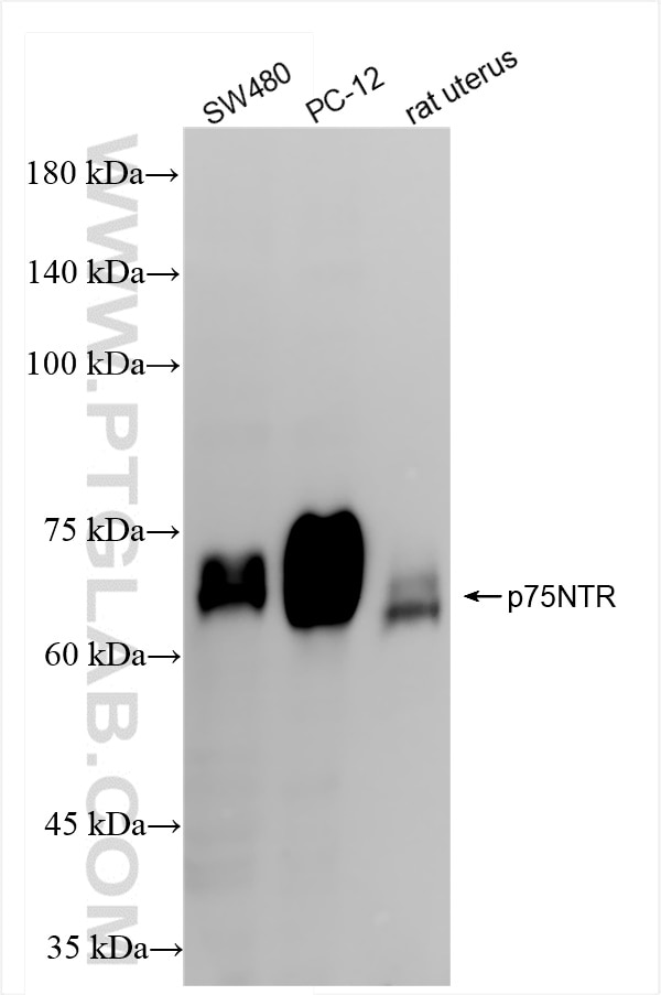 Western Blot (WB) analysis of various lysates using NGFR/TNFRSF16 Recombinant antibody (85192-1-RR)