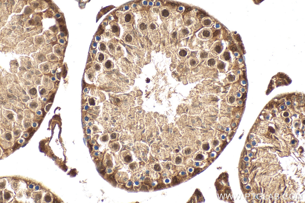 Immunohistochemistry (IHC) staining of mouse testis tissue using AKT Polyclonal antibody (27809-1-AP)