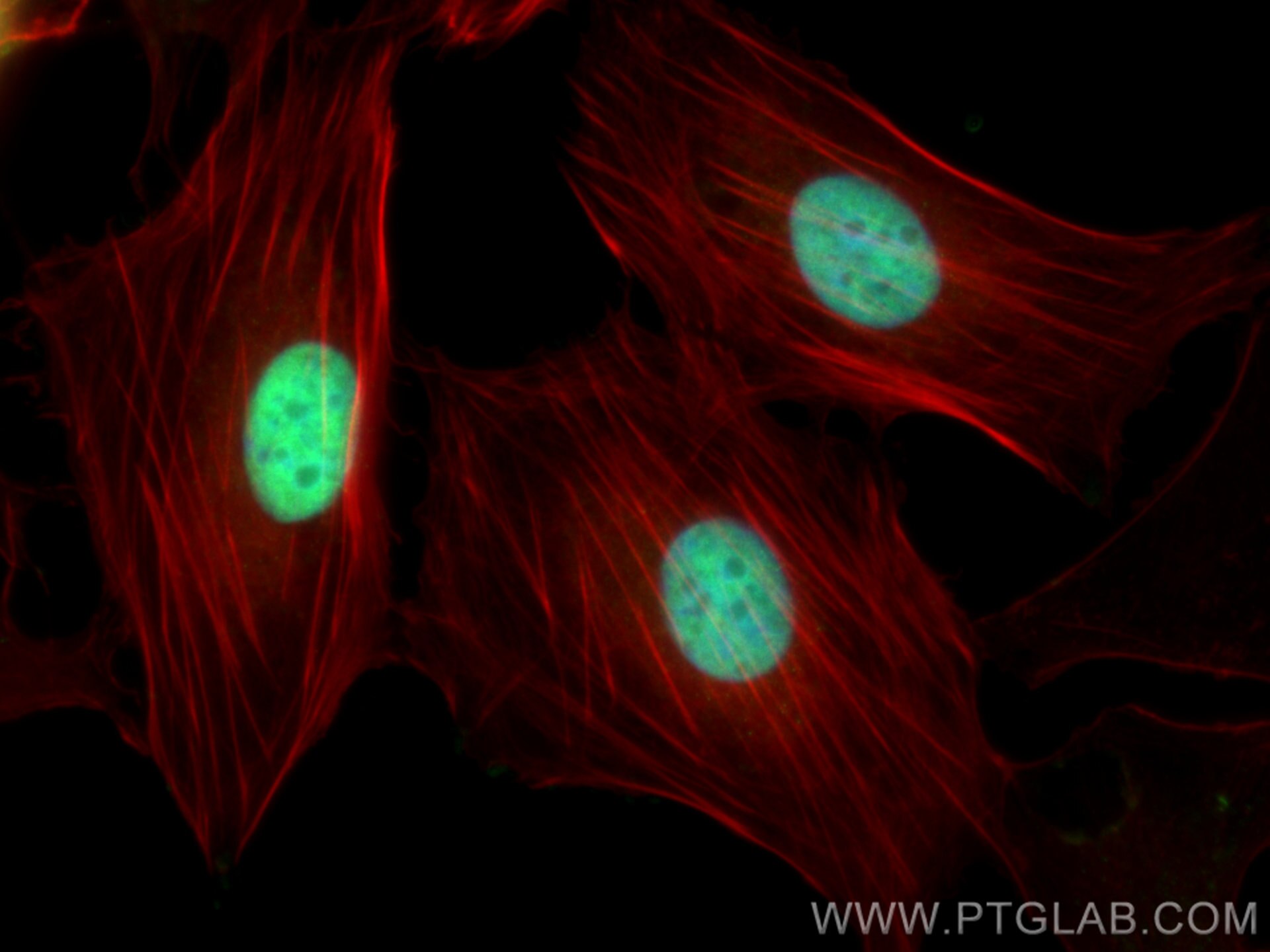 Immunofluorescence (IF) / fluorescent staining of SKOV-3 cells using Pan-PAX Polyclonal antibody (21383-1-AP)