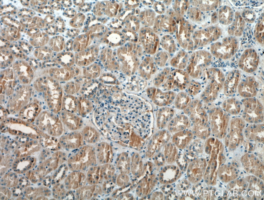 Immunohistochemistry (IHC) staining of human kidney tissue using Pan-PAX Polyclonal antibody (21383-1-AP)