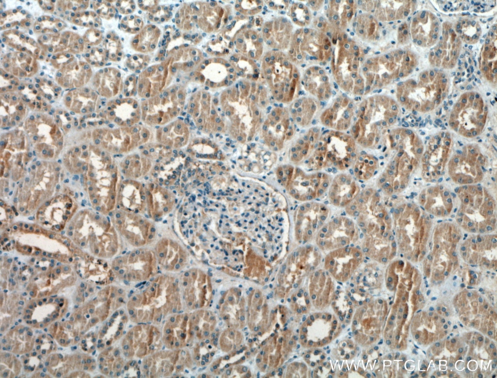 IHC staining of human kidney using 21383-1-AP