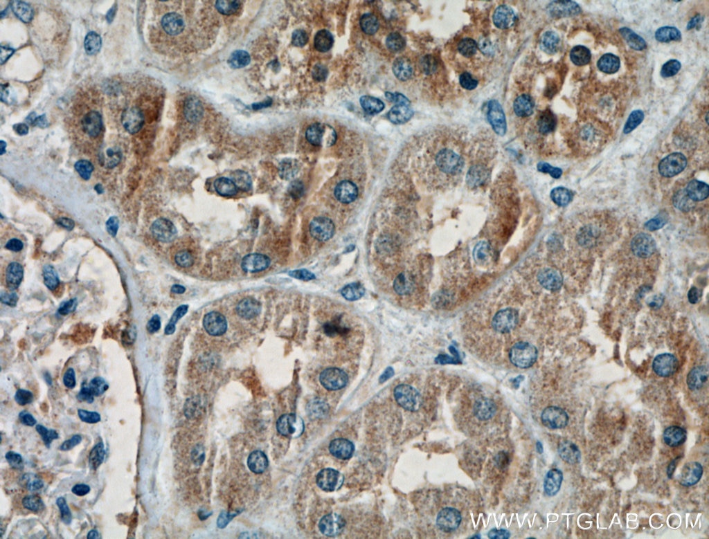 IHC staining of human kidney using 21383-1-AP