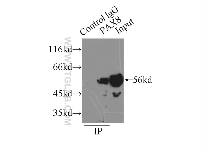 IP experiment of SKOV-3 using 21383-1-AP