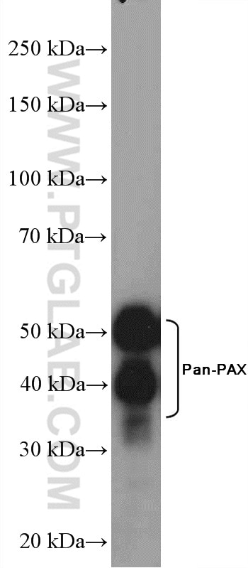 Western Blot (WB) analysis of SKOV-3 cells using Pan-PAX Polyclonal antibody (21383-1-AP)