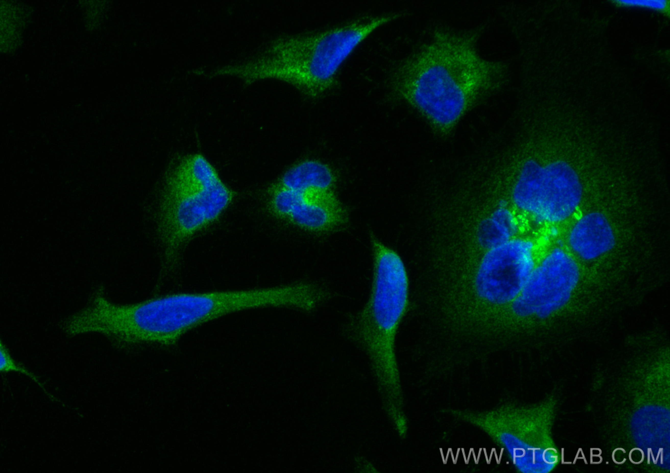 Immunofluorescence (IF) / fluorescent staining of HeLa cells using pan-RAS Recombinant antibody (81615-1-RR)