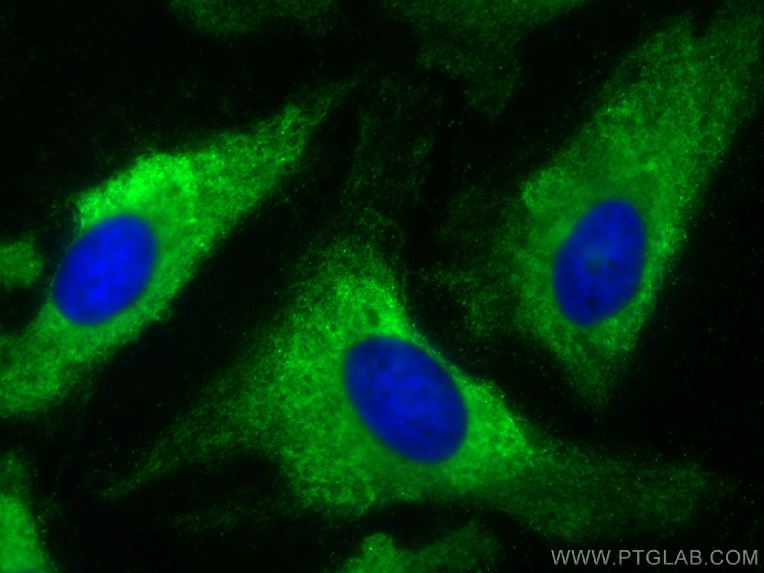 IF Staining of HeLa using CL488-81615