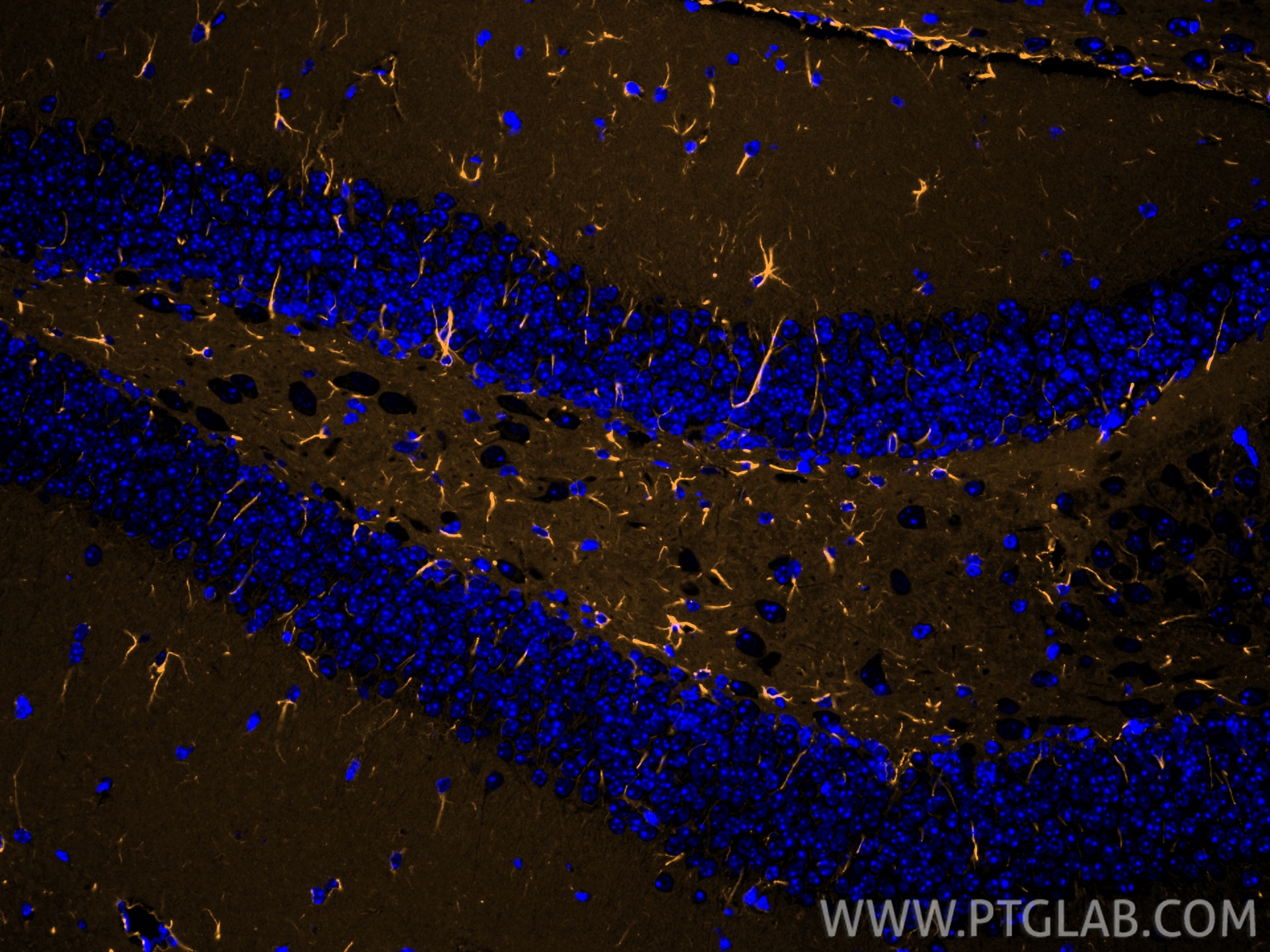 Immunofluorescence (IF) / fluorescent staining of mouse brain tissue using CoraLite®555-conjugated pan Ras Monoclonal antibod (CL555-60309)