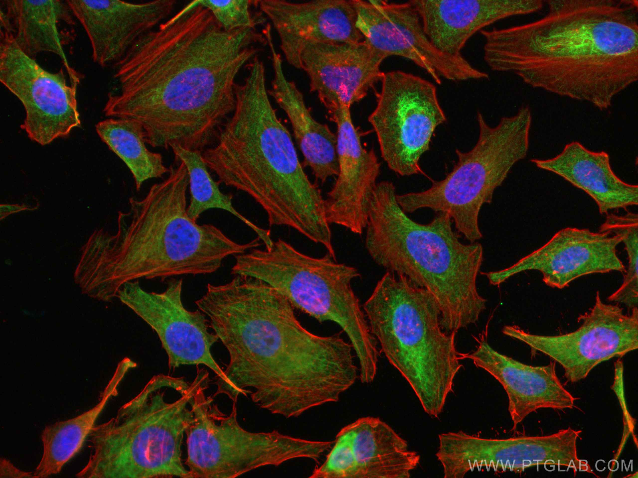 Immunofluorescence (IF) / fluorescent staining of HeLa cells using pan-keratin Polyclonal antibody (26411-1-AP)