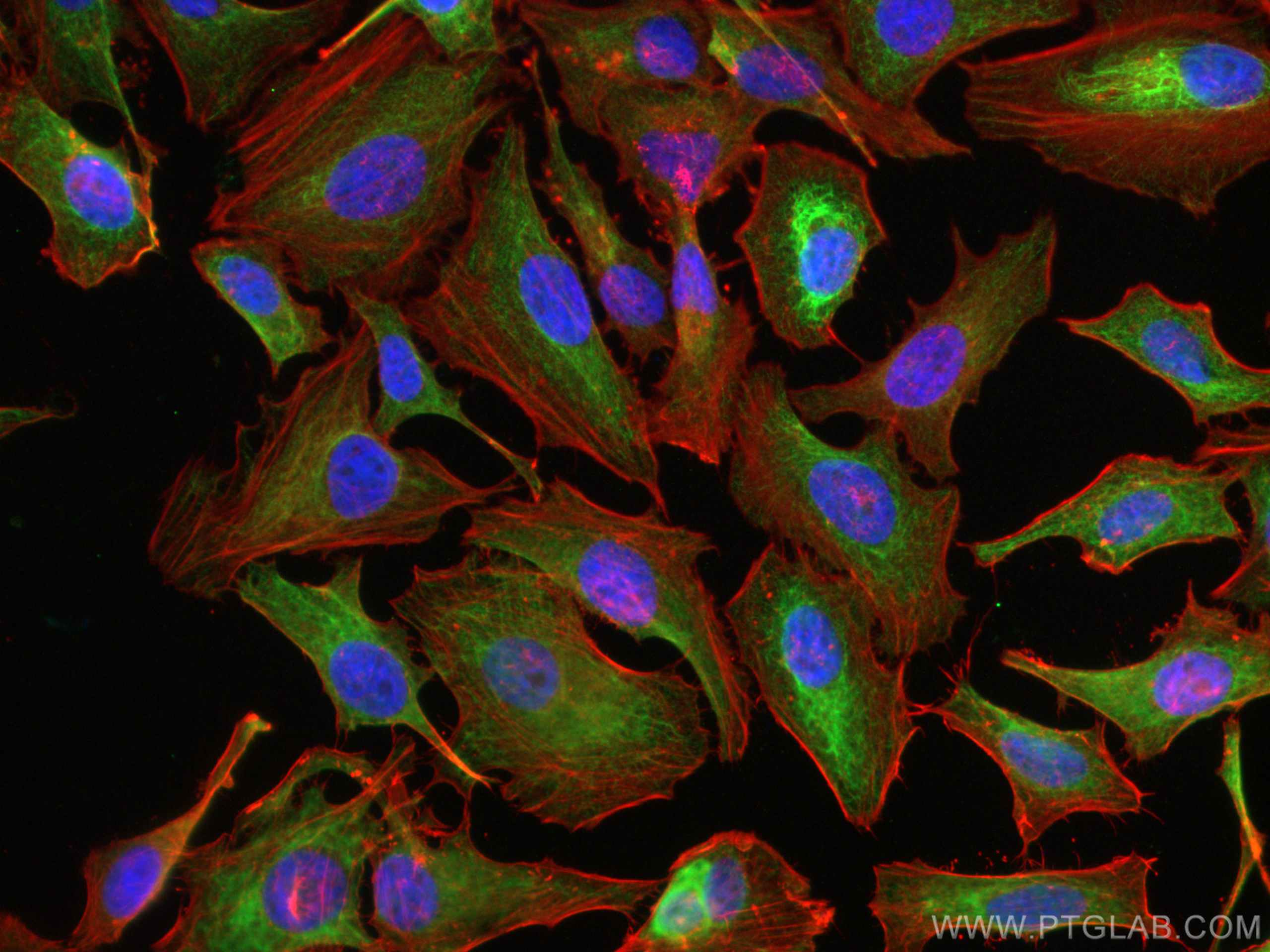 IF Staining of HeLa using 26411-1-AP