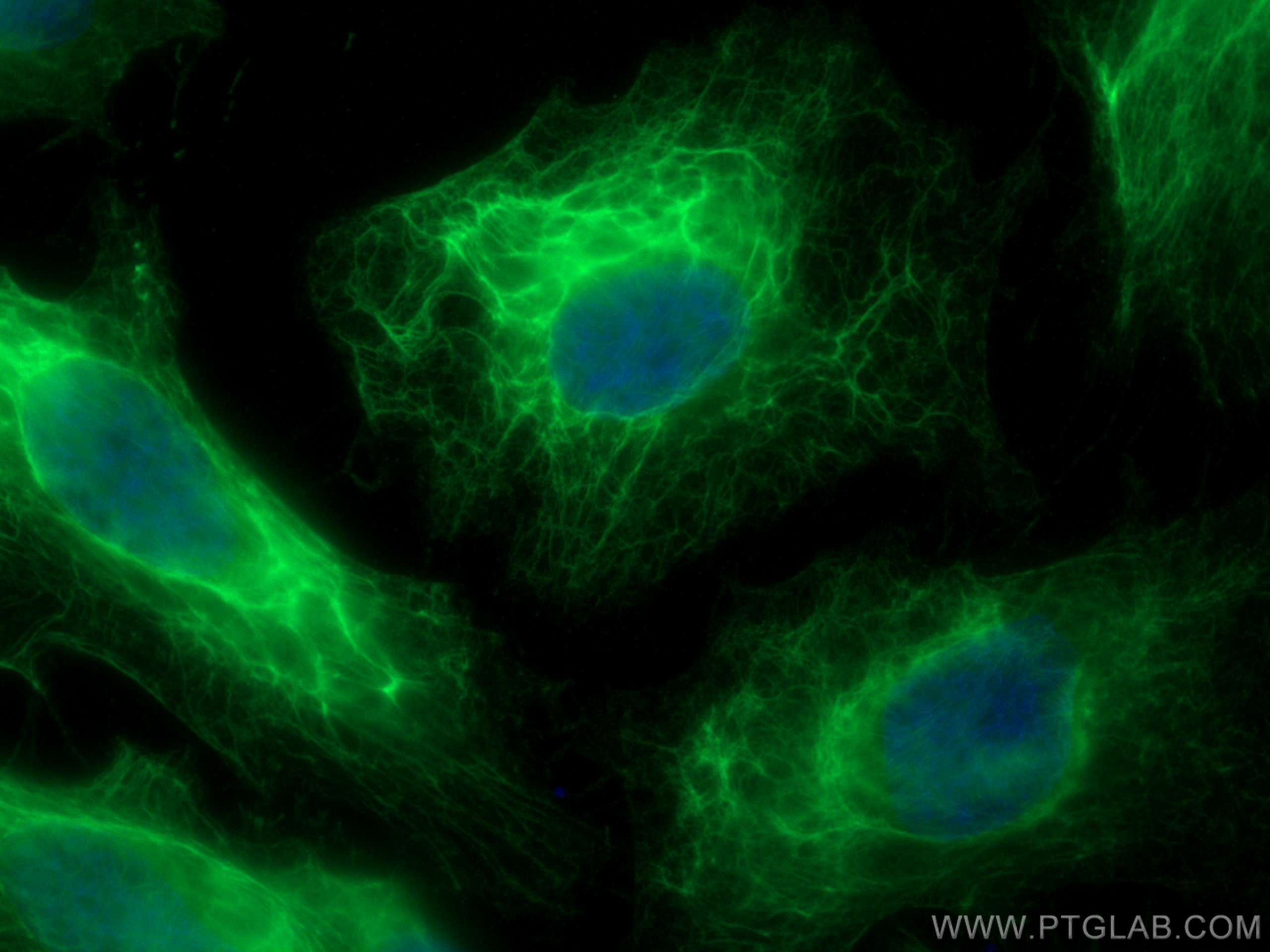 Immunofluorescence (IF) / fluorescent staining of HeLa cells using pan-keratin Polyclonal antibody (26411-1-AP)