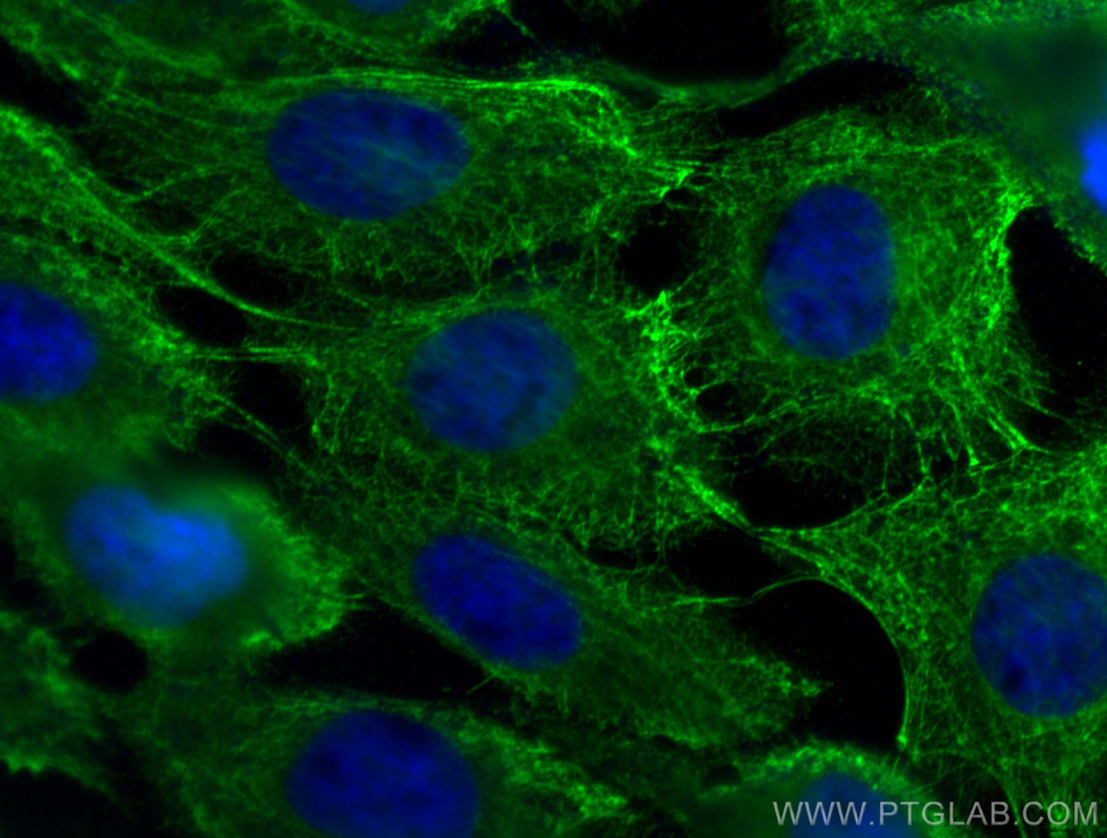 Immunofluorescence (IF) / fluorescent staining of A431 cells using pan-keratin Polyclonal antibody (26411-1-AP)