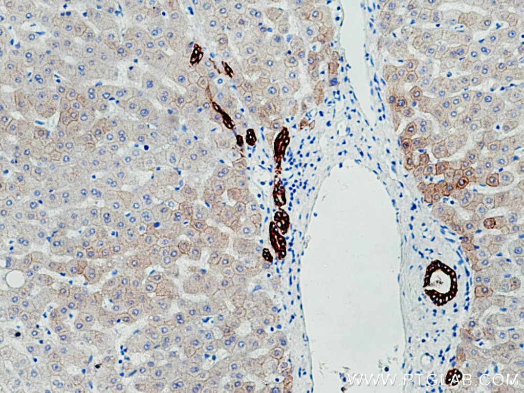 Immunohistochemistry (IHC) staining of human liver tissue using pan-keratin Polyclonal antibody (26411-1-AP)