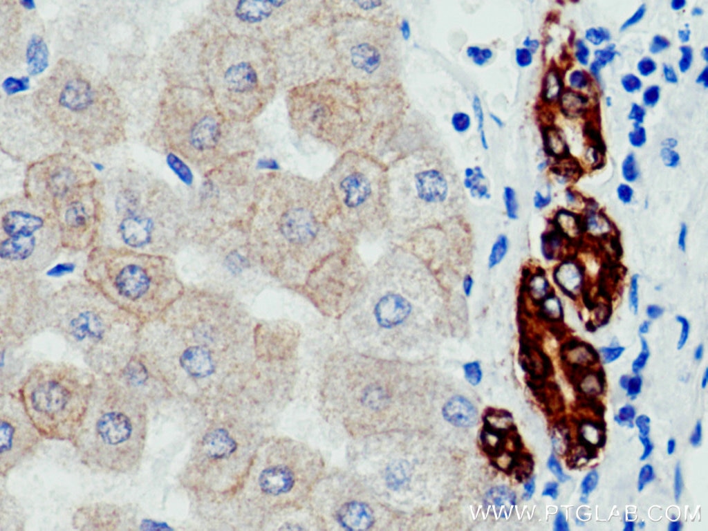 Immunohistochemistry (IHC) staining of human liver tissue using pan-keratin Polyclonal antibody (26411-1-AP)