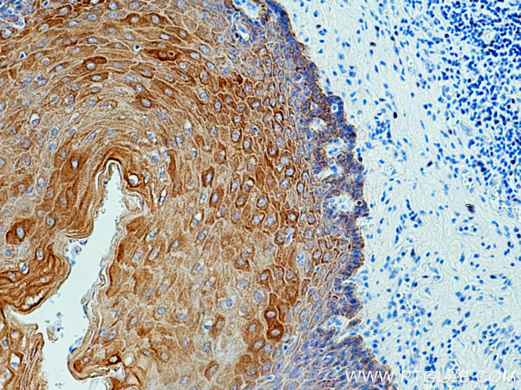 Immunohistochemistry (IHC) staining of human oesophagus tissue using pan-keratin Polyclonal antibody (26411-1-AP)