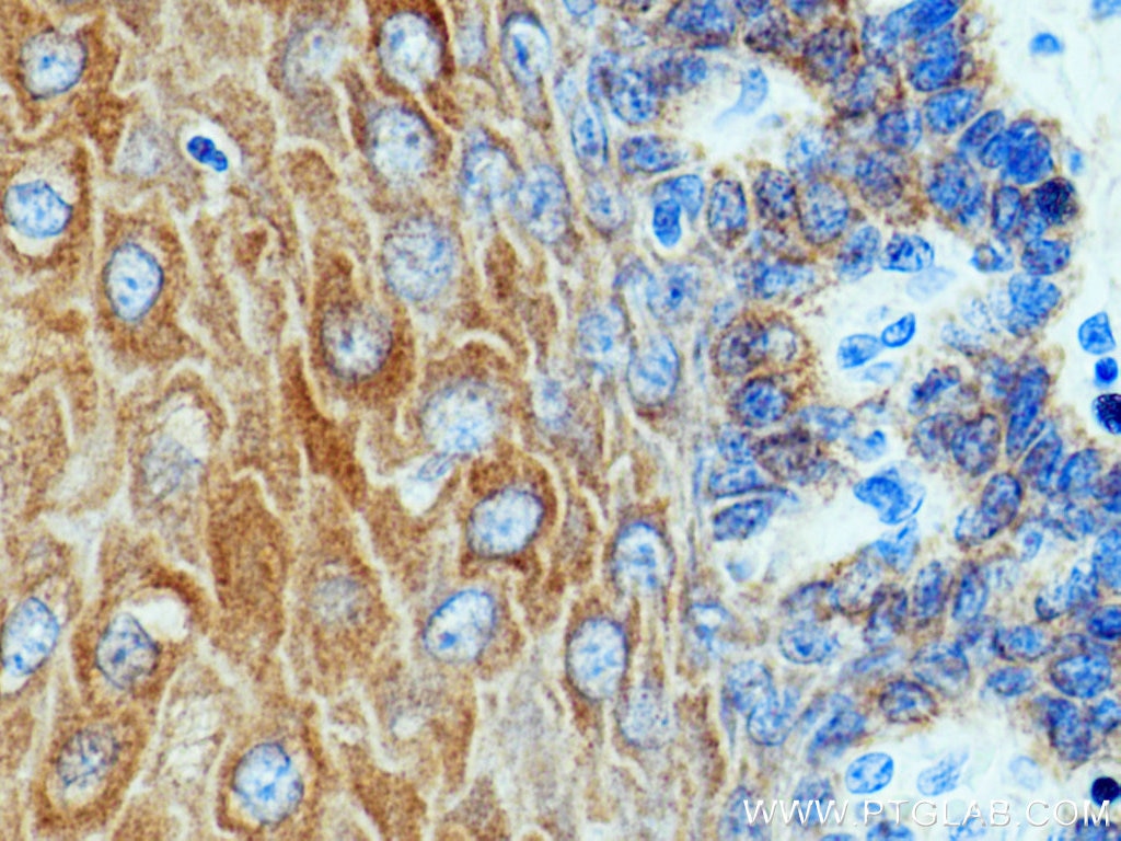 Immunohistochemistry (IHC) staining of human oesophagus tissue using pan-keratin Polyclonal antibody (26411-1-AP)