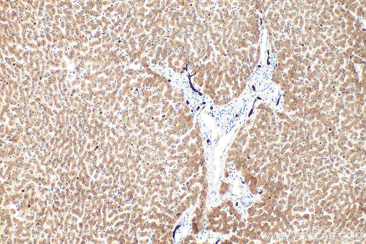 Immunohistochemistry (IHC) staining of human liver tissue using Pan-Keratin Polyclonal antibody (26411-1-AP)
