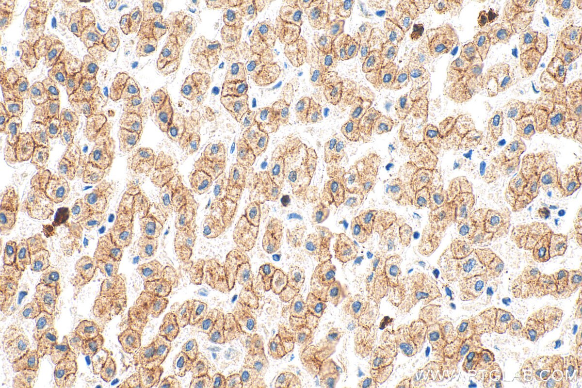 Immunohistochemistry (IHC) staining of human liver tissue using Pan-Keratin Polyclonal antibody (26411-1-AP)