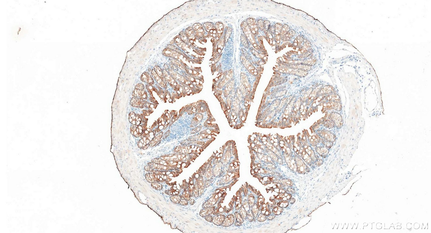 Immunohistochemistry (IHC) staining of mouse colon tissue using Pan-Keratin Polyclonal antibody (26411-1-AP)