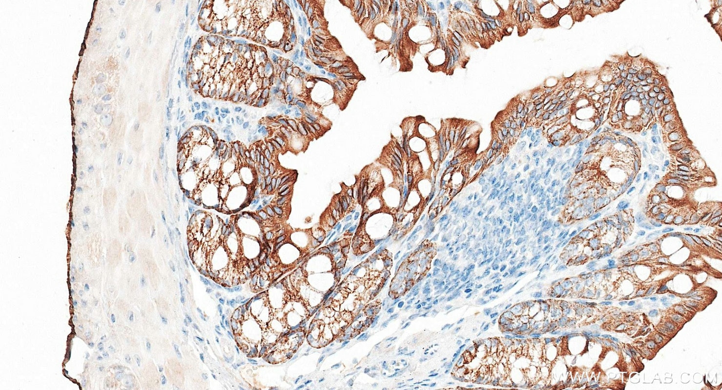 Immunohistochemistry (IHC) staining of mouse colon tissue using Pan-Keratin Polyclonal antibody (26411-1-AP)
