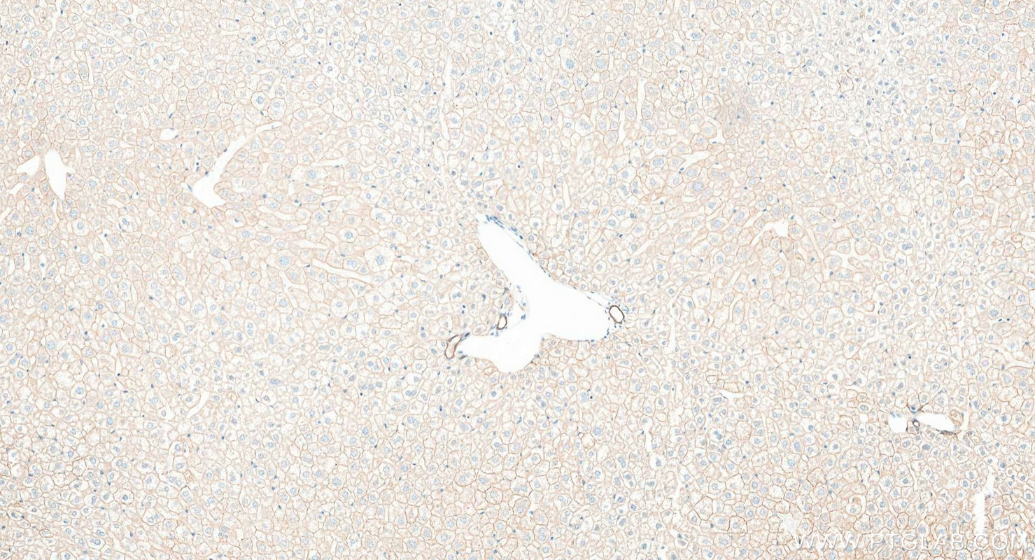 Immunohistochemistry (IHC) staining of mouse liver tissue using Pan-Keratin Polyclonal antibody (26411-1-AP)
