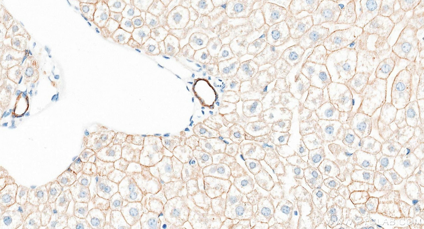 Immunohistochemistry (IHC) staining of mouse liver tissue using Pan-Keratin Polyclonal antibody (26411-1-AP)