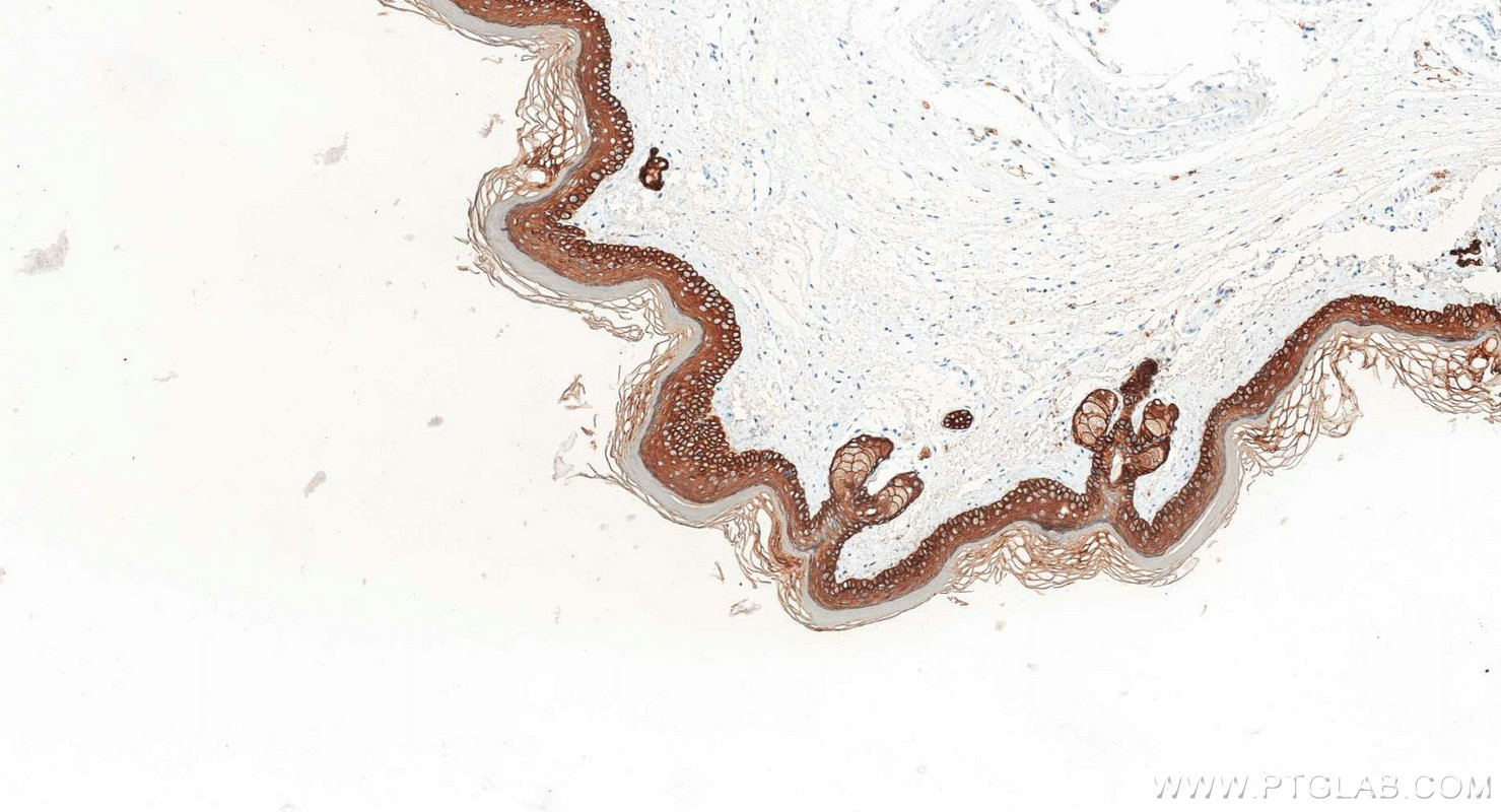 Immunohistochemistry (IHC) staining of mouse skin tissue using Pan-Keratin Polyclonal antibody (26411-1-AP)
