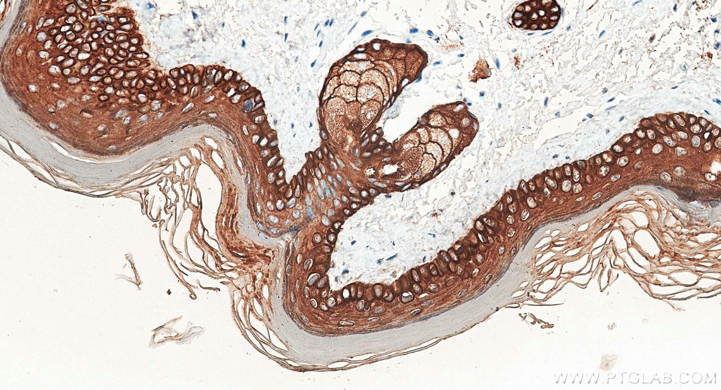 Immunohistochemistry (IHC) staining of mouse skin tissue using Pan-Keratin Polyclonal antibody (26411-1-AP)