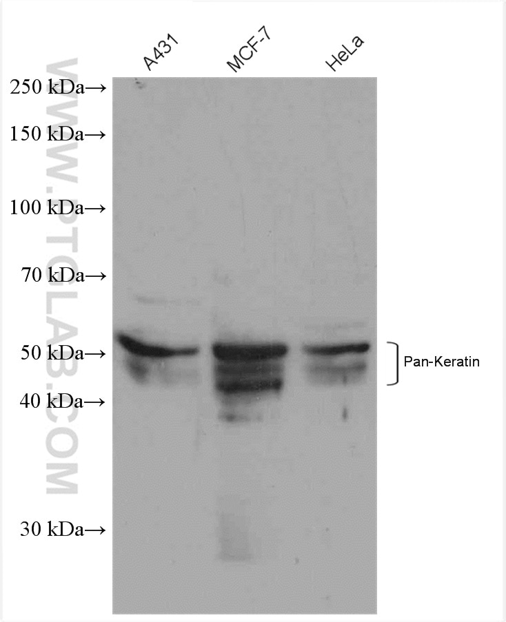 Western Blot (WB) analysis of various lysates using pan-keratin Polyclonal antibody (26411-1-AP)