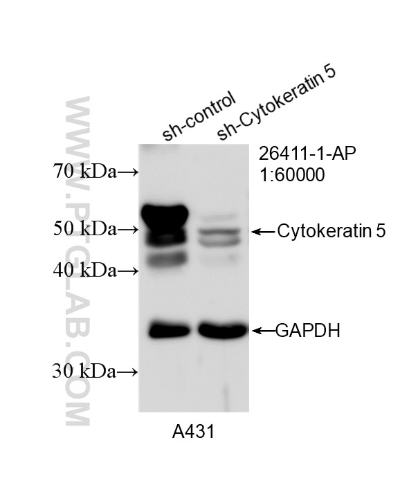 Western Blot (WB) analysis of A431 cells using Pan-Keratin Polyclonal antibody (26411-1-AP)
