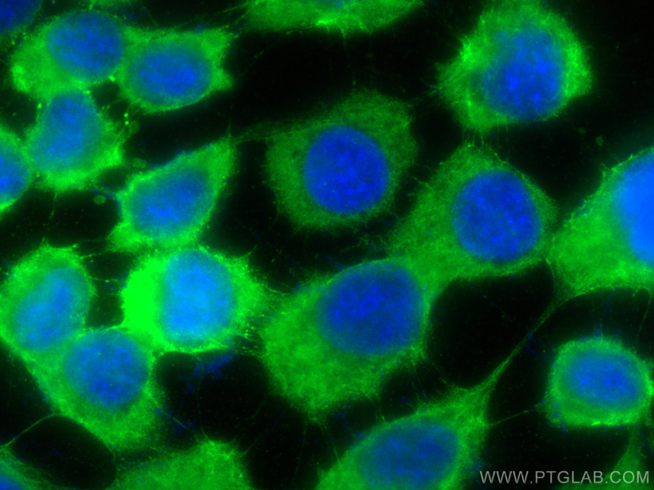 Immunofluorescent analysis of (-20°C Methanol) fixed A431 cells using KRT5 antibody (82548-3-RR, Clone: 7J23 ) at dilution of 1:400 and CoraLite®488-Conjugated Goat Anti-Rabbit IgG(H+L). Immunofluorescence (IF) / fluorescent staining of A431 cells using pan-keratin Recombinant antibody (82548-3-RR)