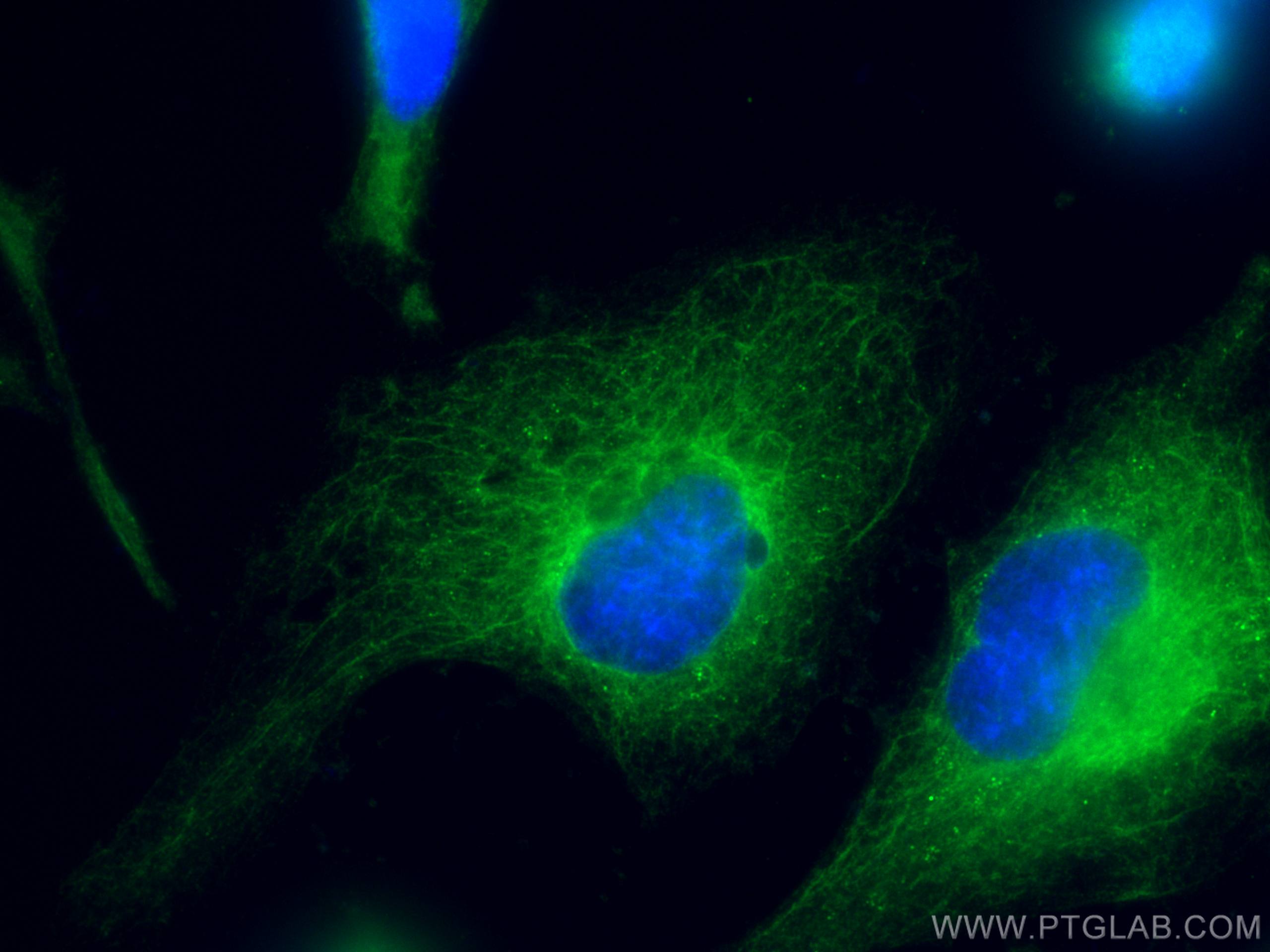 Immunofluorescence (IF) / fluorescent staining of HeLa cells using CoraLite® Plus 488-conjugated pan-keratin Polyclon (CL488-26411)