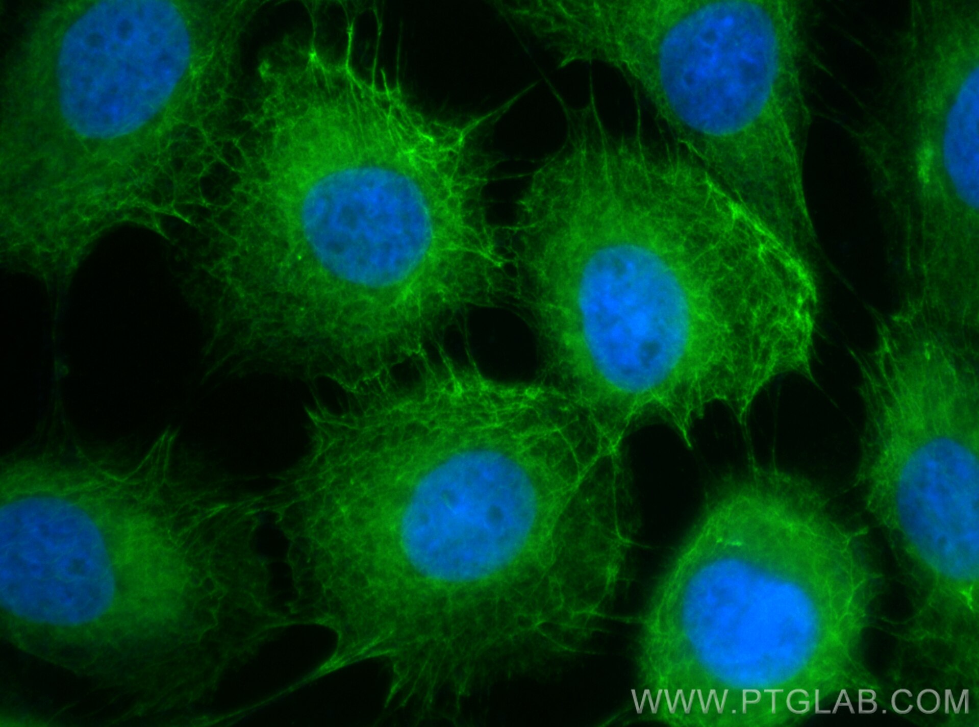 IF Staining of A431 using CL488-26411 Immunofluorescence (IF) / fluorescent staining of A431 cells using CoraLite® Plus 488-conjugated pan-keratin Polyclon (CL488-26411)