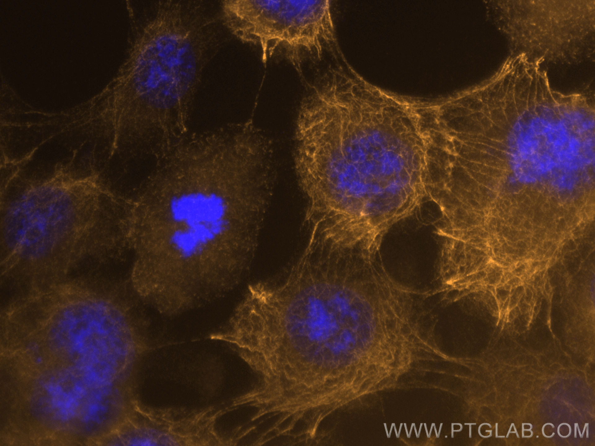 Immunofluorescence (IF) / fluorescent staining of A431 cells using CoraLite®555-conjugated pan-keratin Polyclonal ant (CL555-26411)