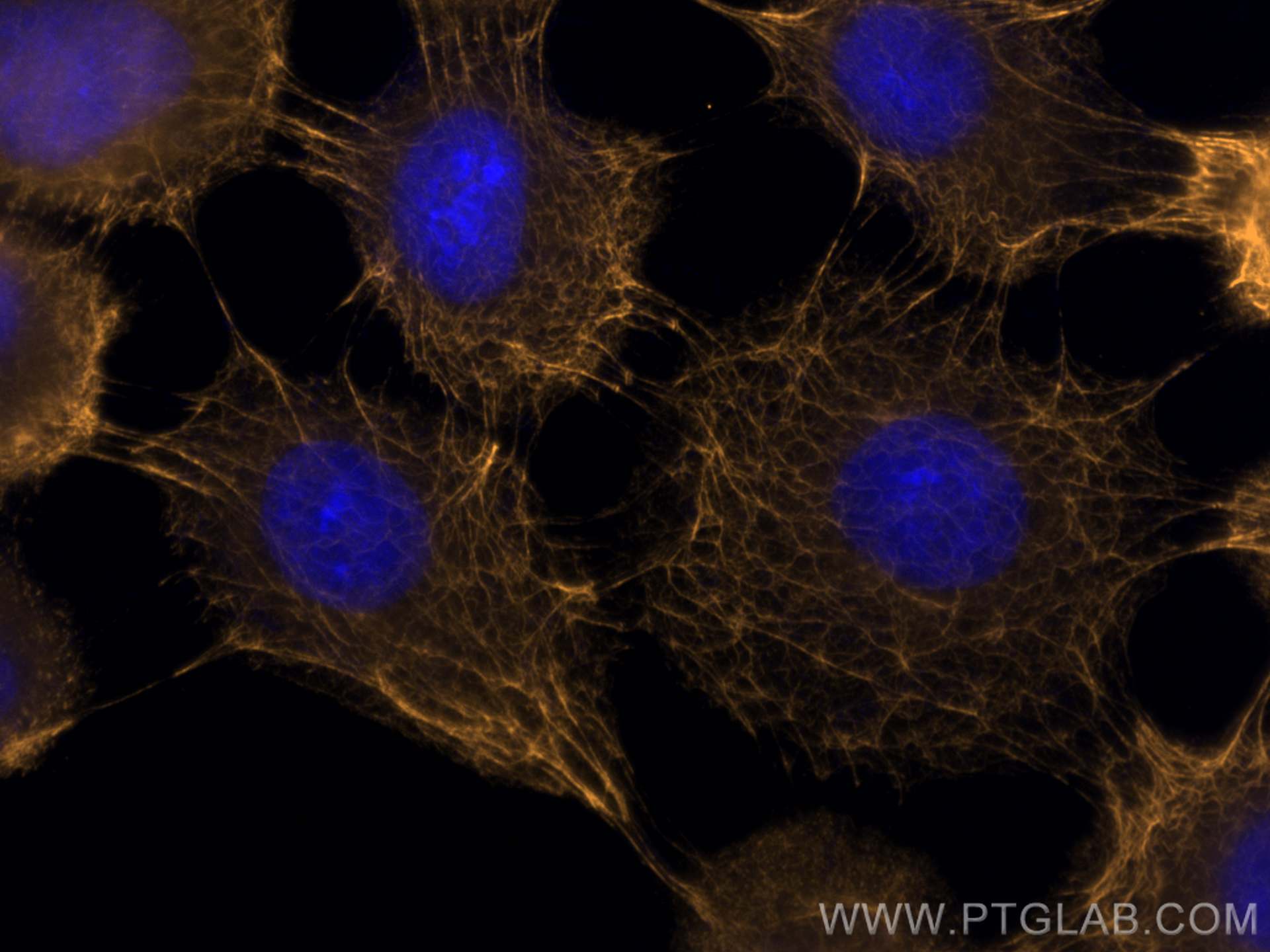 Immunofluorescence (IF) / fluorescent staining of A431 cells using CoraLite®555-conjugated pan-keratin Polyclonal ant (CL555-26411)