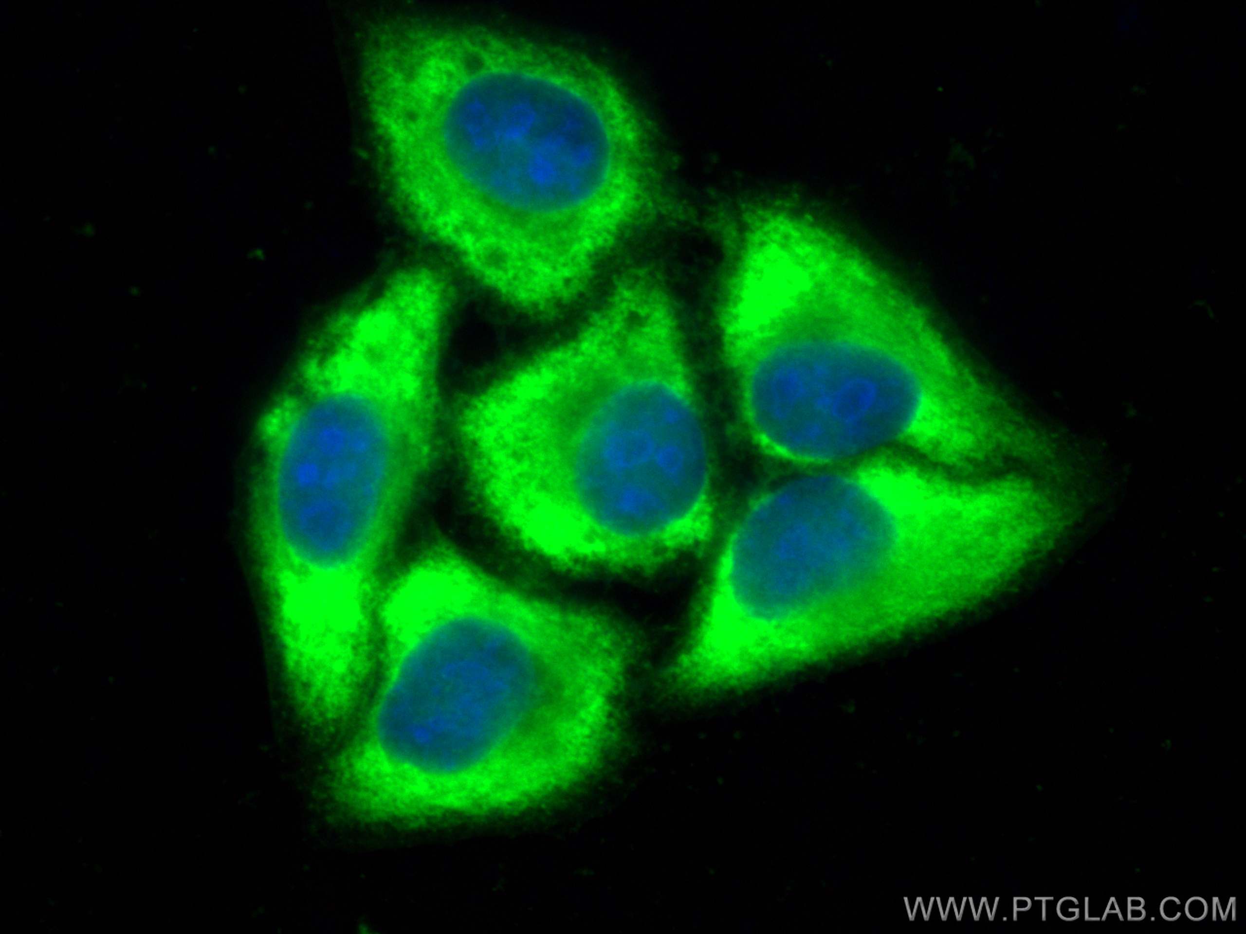 peroxiredoxin 2