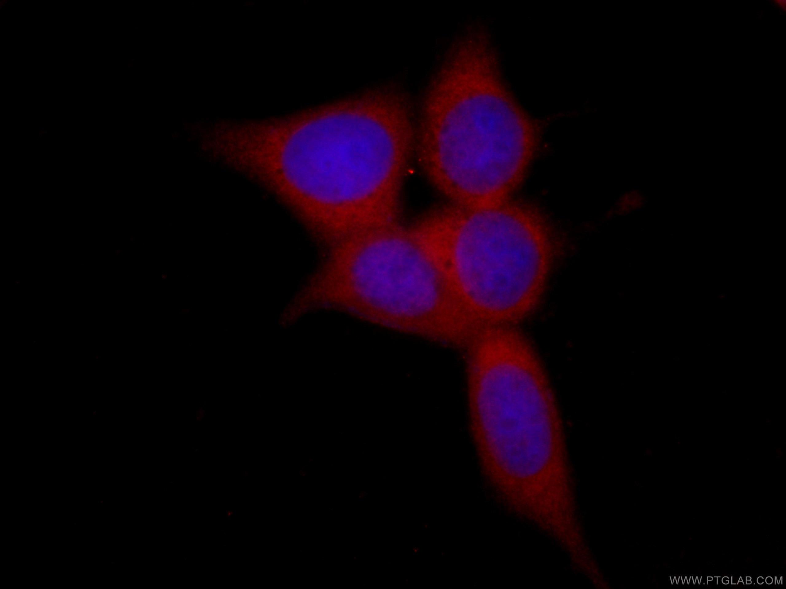 peroxiredoxin 2