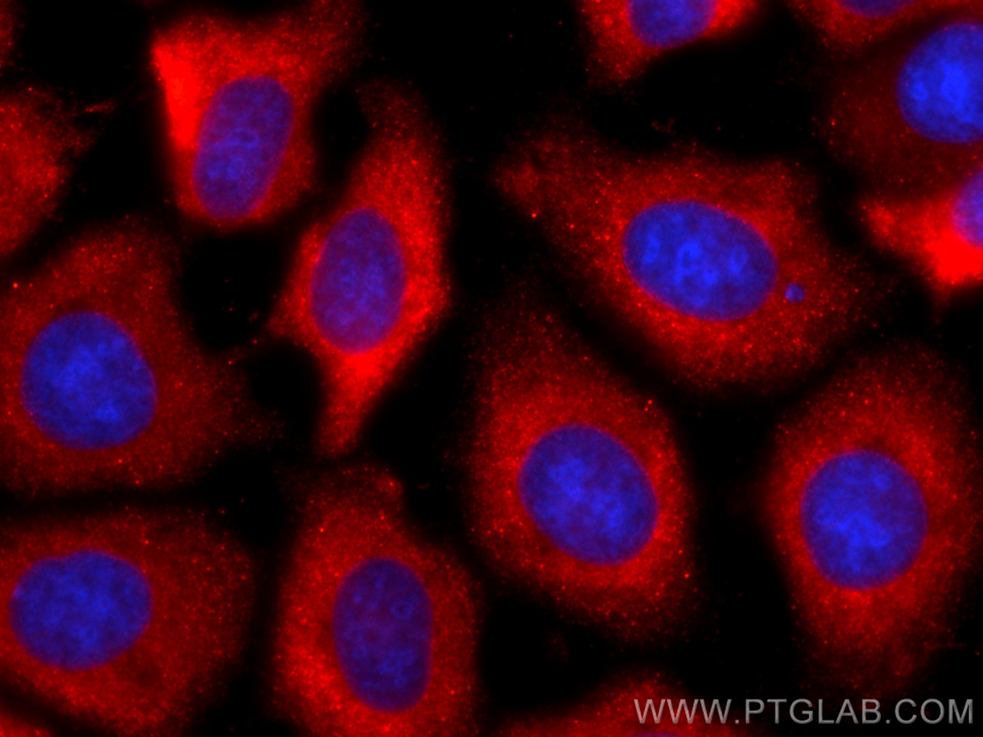 Immunofluorescence (IF) / fluorescent staining of MCF-7 cells using CoraLite®594-conjugated peroxiredoxin 2 Monoclonal (CL594-60202)