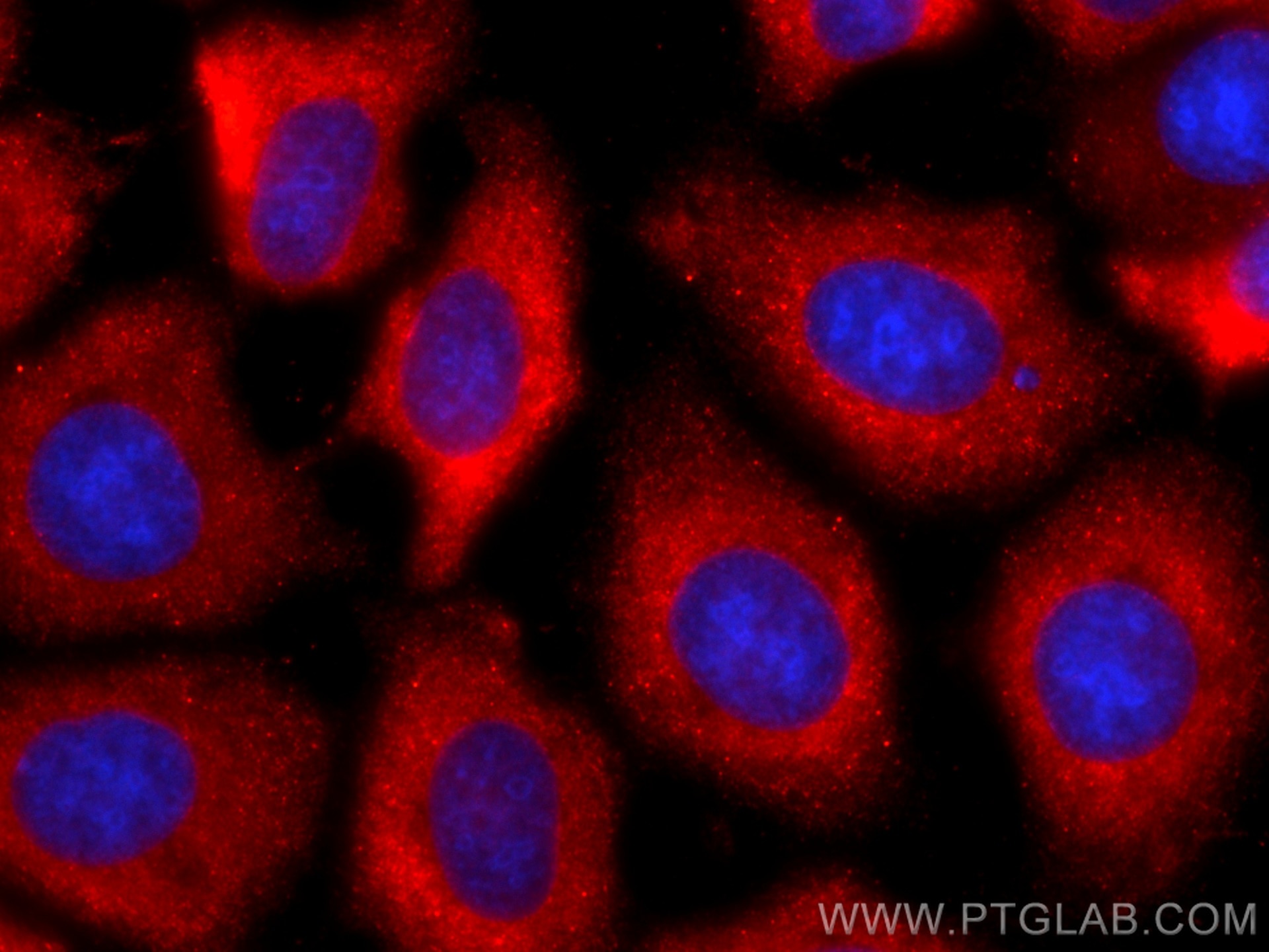 IF Staining of MCF-7 using CL594-60202