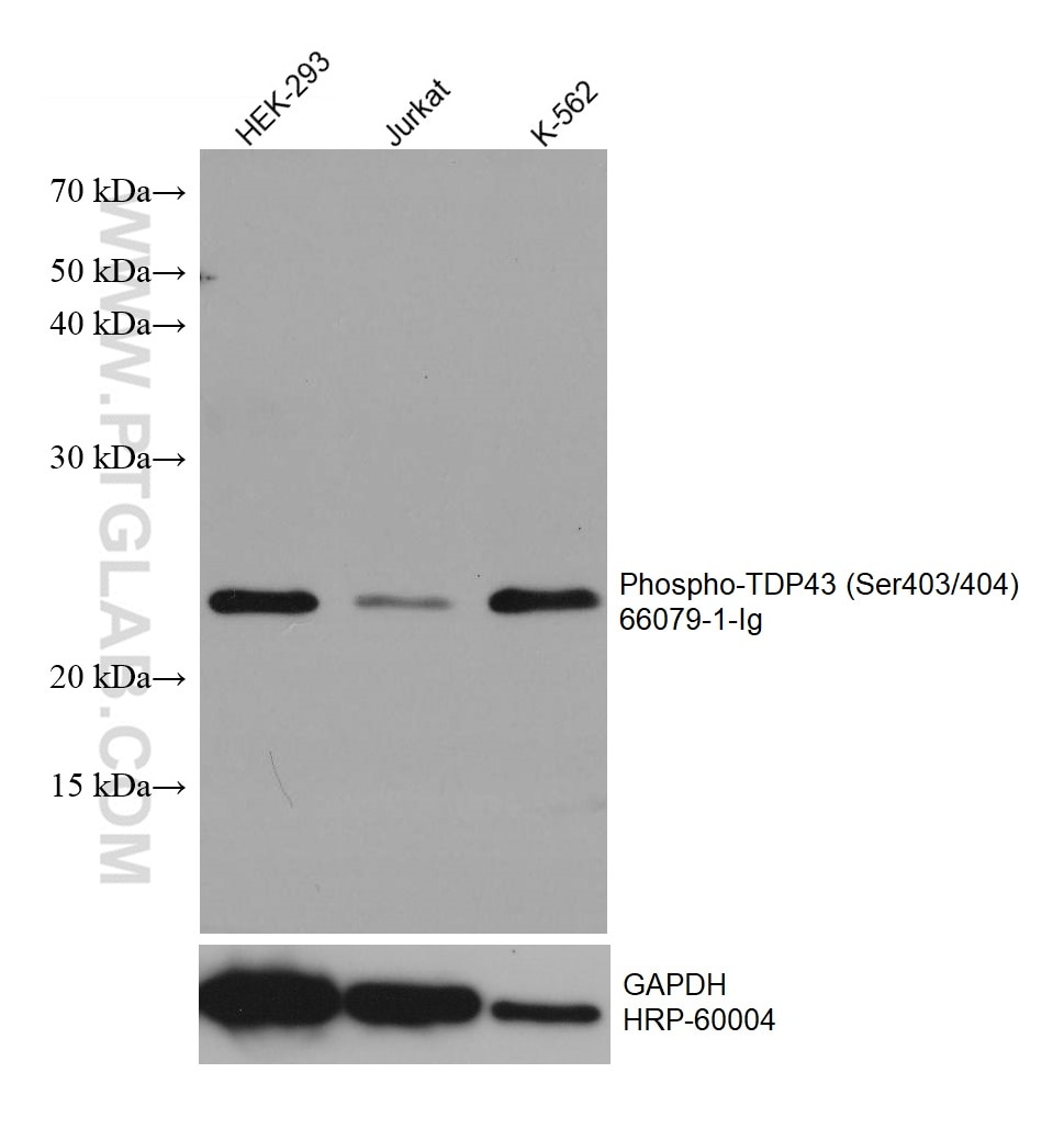 Western Blot (WB) analysis of various lysates using Phospho-TDP43 (Ser403/404) Monoclonal antibody (66079-1-Ig)