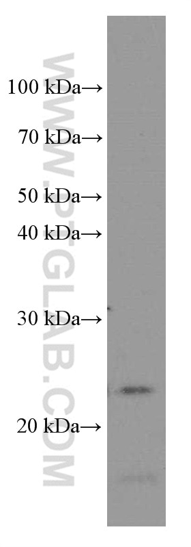 WB analysis of fetal human brain using 66079-1-Ig