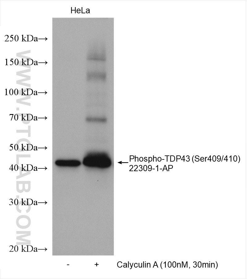 Western Blot (WB) analysis of various lysates using Phospho-TDP43 (Ser409/410) Polyclonal antibody (22309-1-AP)